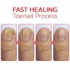 NailHelper Ingrowth Toenail Correction Treatment Oil